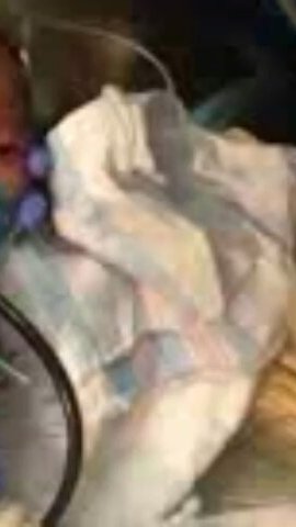 ارزیابی آسیب شناسی نوزاد در nicu