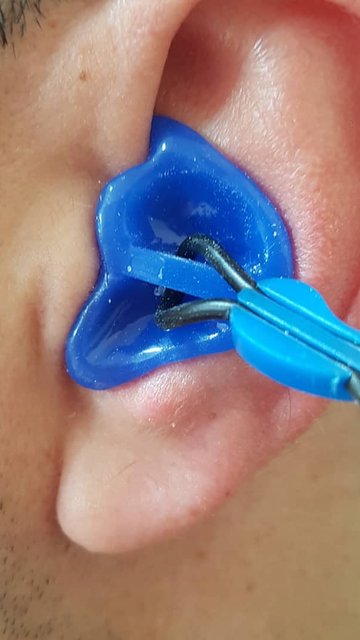 قالبهای ضد آب برای محافظت گوش در آب