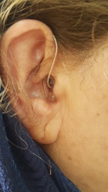 سمعک پشت گوشی ریک در دفتر ارزیابی شنوایی