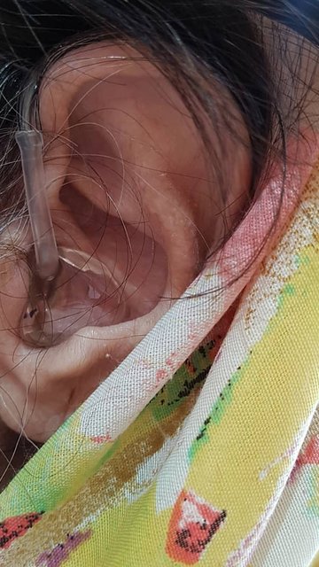 سمعک پشت گوشی سایز متوسط در فردیس