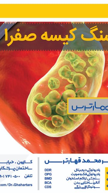 پاک سازی کیسه صفرا برای جلوگیری از مشکلات