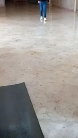 بیمار عزیز پس از جراحی مفصل راه می رود.