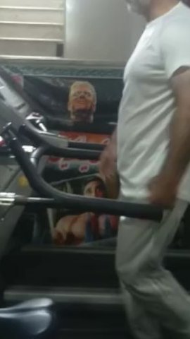 بازگشت به ورزش پس از جراحی لگن