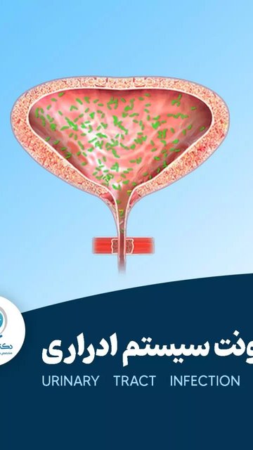 پیشگیری از عفونت ادراری، نکات مهم