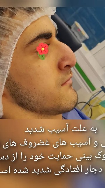 عمل جراحی بینی دشوار با تخصص آرایشی حلق و بینی