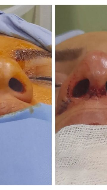 متخصص جراحی پلاستیک بینی در قزوین