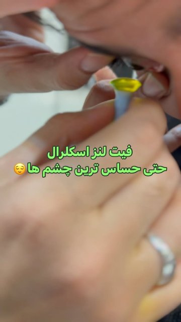 لنز اسکلرال فرصتی برای دید بهتر