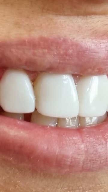 blog-post