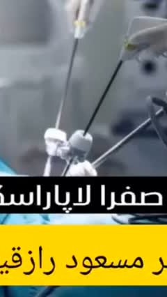 لاپاراسکوپی کیسه صفرا، جراحی کم تهاجمی با فواید بسیار بالا