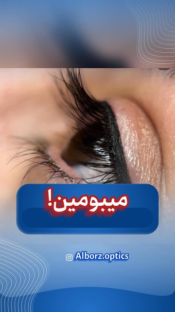 اهمیت رعایت بهداشت چشمی و عوارض آن