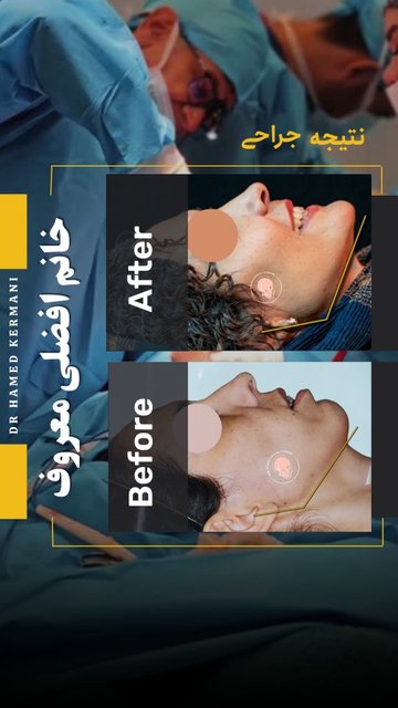 جراحی پیچیده با نتایج عالی، تشکر از ارتودنسی خوب