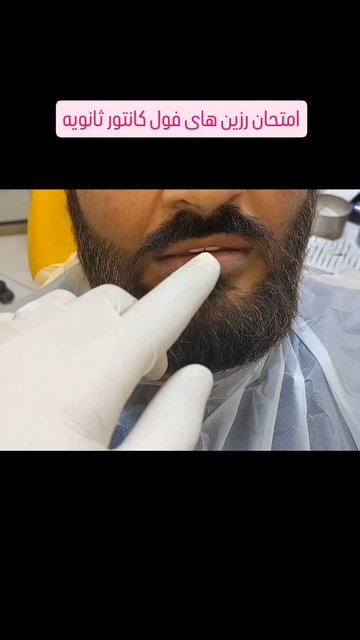 بازسازی دقیق، کلید به ادجاست پرسلن با کیفیت