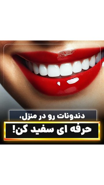 دندان های سفید و درخشان در خانه