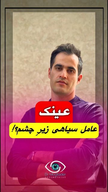 ارتباط بین عینک و سیاهی زیر چشم