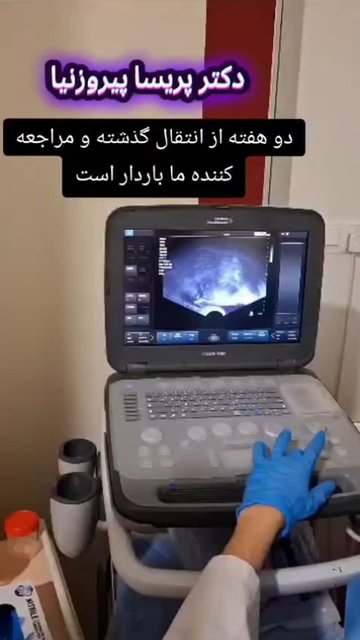 شروع بارداری،دو هفته بعد از انتقال