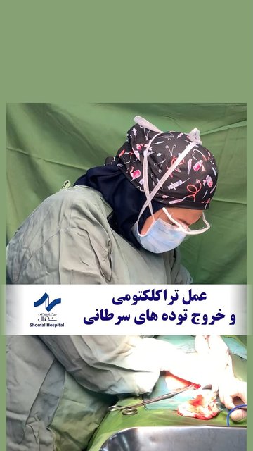 تراکلکتومی، فرصتی دوباره برای بیماران جوان