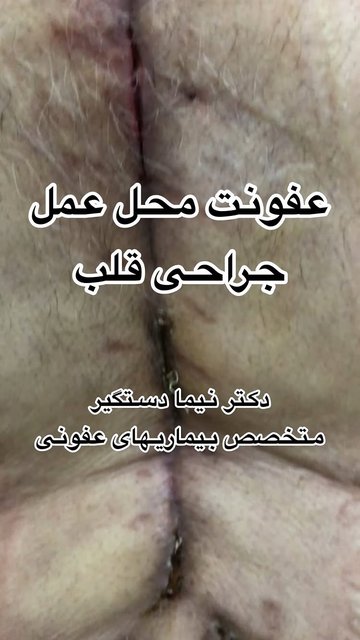 پزشک متخصص درمان استخوان و عفونتهای بافت نرم