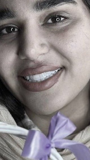 طراحی لبخند زیبا برای بلاگران باشید