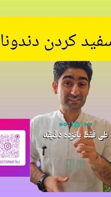 سفید کردن دندان ها در ۱۵ دقیقه! تماس، ۰۲۵۳۲۶۱۵۶۲۰ (جهت سفارش)