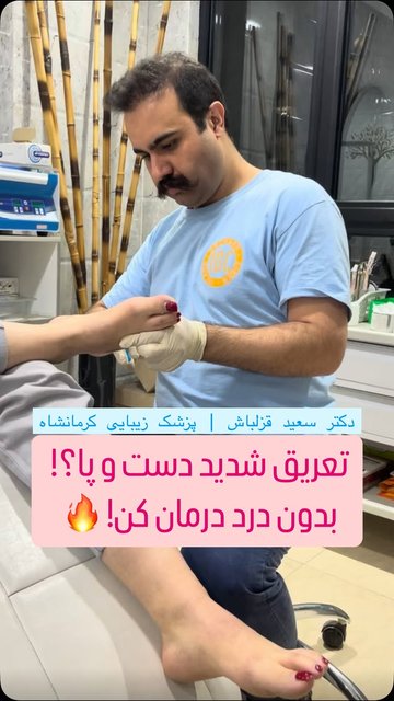 کاهش تعریق موضعی با بوتاکس در کرمانشاه