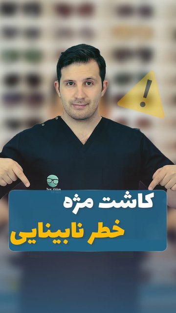 مخاطرات کاشت مژه و راه های پیشگیری