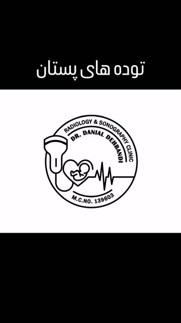 توده های پستان در مرکز ساوالان
(ساری، خیابان فرهنگ، ساختمان پزشکان)