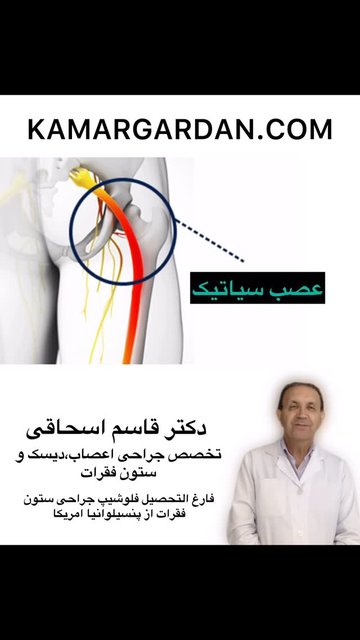آناتومی عصب سیاتیک و علائم سیاتیک