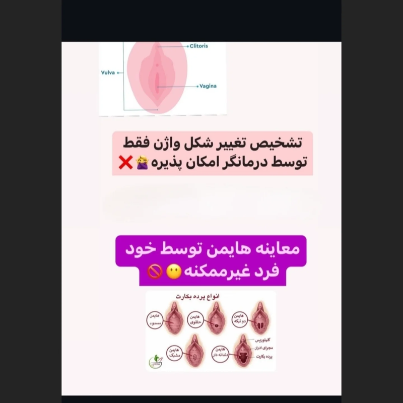 معاینه بکارت، راهکاری تخصصی برای سلامت زنان