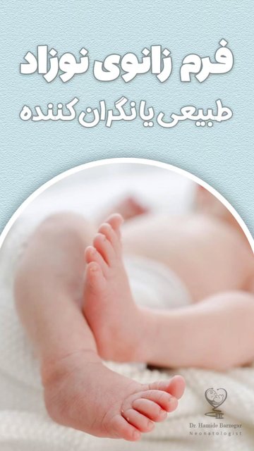 فرم طبیعی پاهای نوزادان و روند رشد