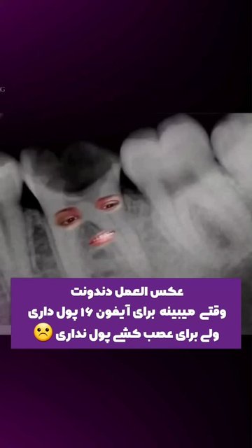 فقر فرهنگی، پرداخت هزینه برای گوشی های لوکس