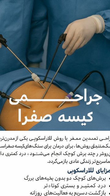 جراحی لاپاراسکوپی کیسه صفرا، مزایا و نکاتی که باید بدانید