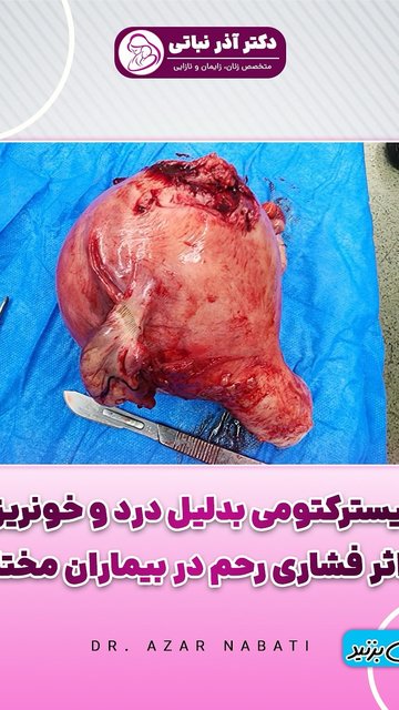 هیسترکتومی، پایان درد، شروع آرامش