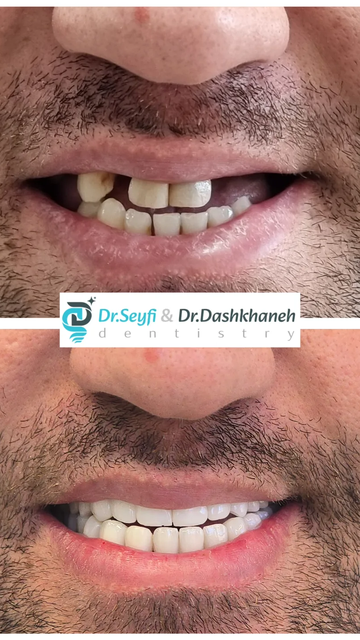 زندگی با لبخند، حل چالش های پروتزی و جراحی