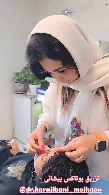 اخم پیشانی با بوتاکس، مشاوره تخصصی در کرج