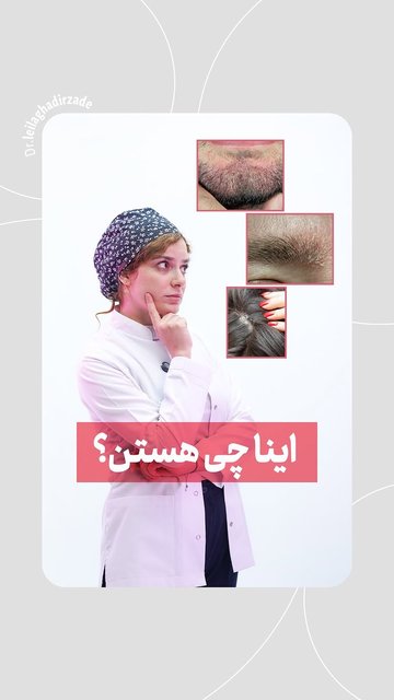 درماتیت سبوره، علائم، درمان و کنترل