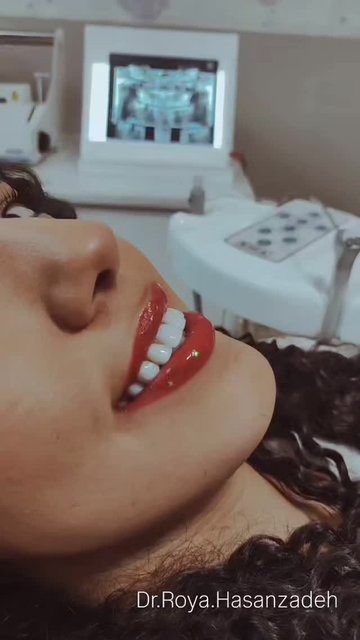 ترکیبی ماندگار و زیبا برای دندان ها