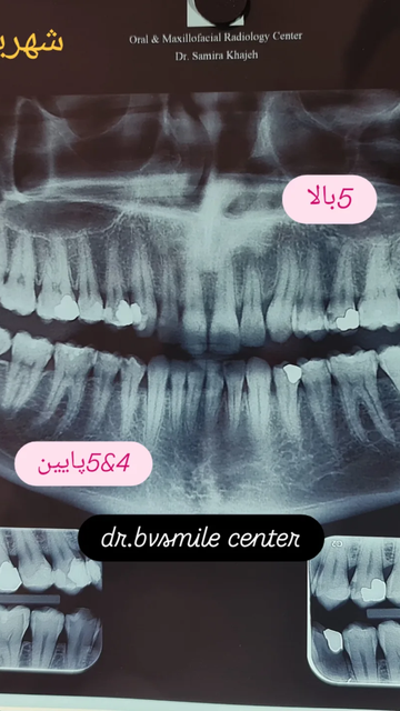 خدمات ریشه کشی و ترمیم دندان درمانی در مرکز دندانپزشکی