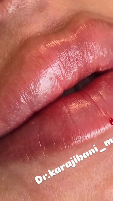 مشاوره تخصصی از دکتر مژگان کرجی بانی