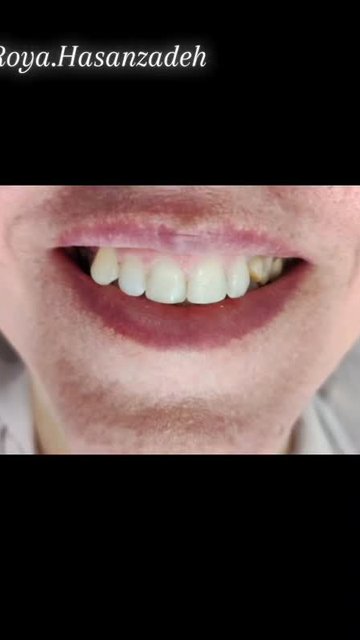 اهمیت مراقبت از دندان ها برای سلامتی دهان