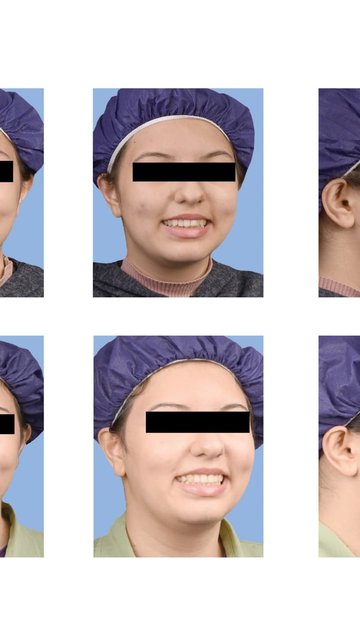 درمان ارتودنسی برای لبخند شاد