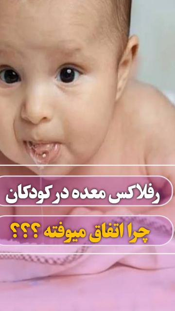 رفلاکس در کودکان، علائم و راهکارهای ساده