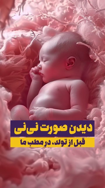 سونوگرافی چهار بعدی رنگی برای بارداری در ساری
