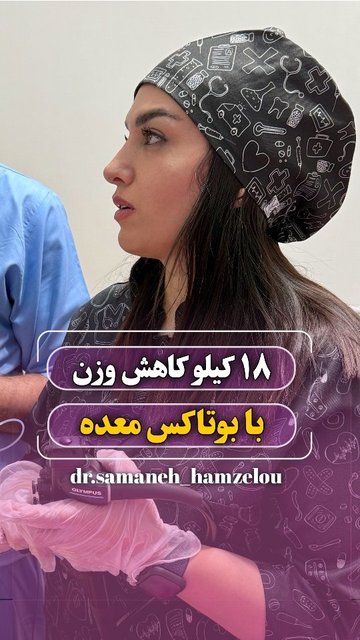 کاهش وزن با بوتاکس معده، فرصتی برای ایده آل شدن