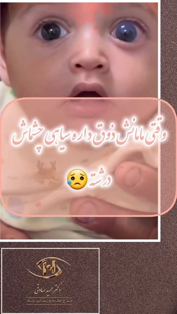 گلوکوم کانژنیتال، علائم، تشخیص و درمان