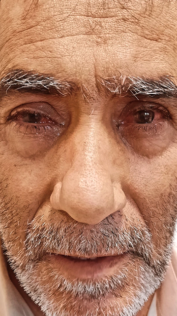 درد سردرد شدید و قرمزی اطراف چشم ها