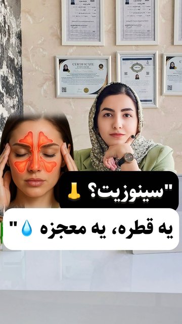 سرماخوردگی معمولی یا سینوزیت؟